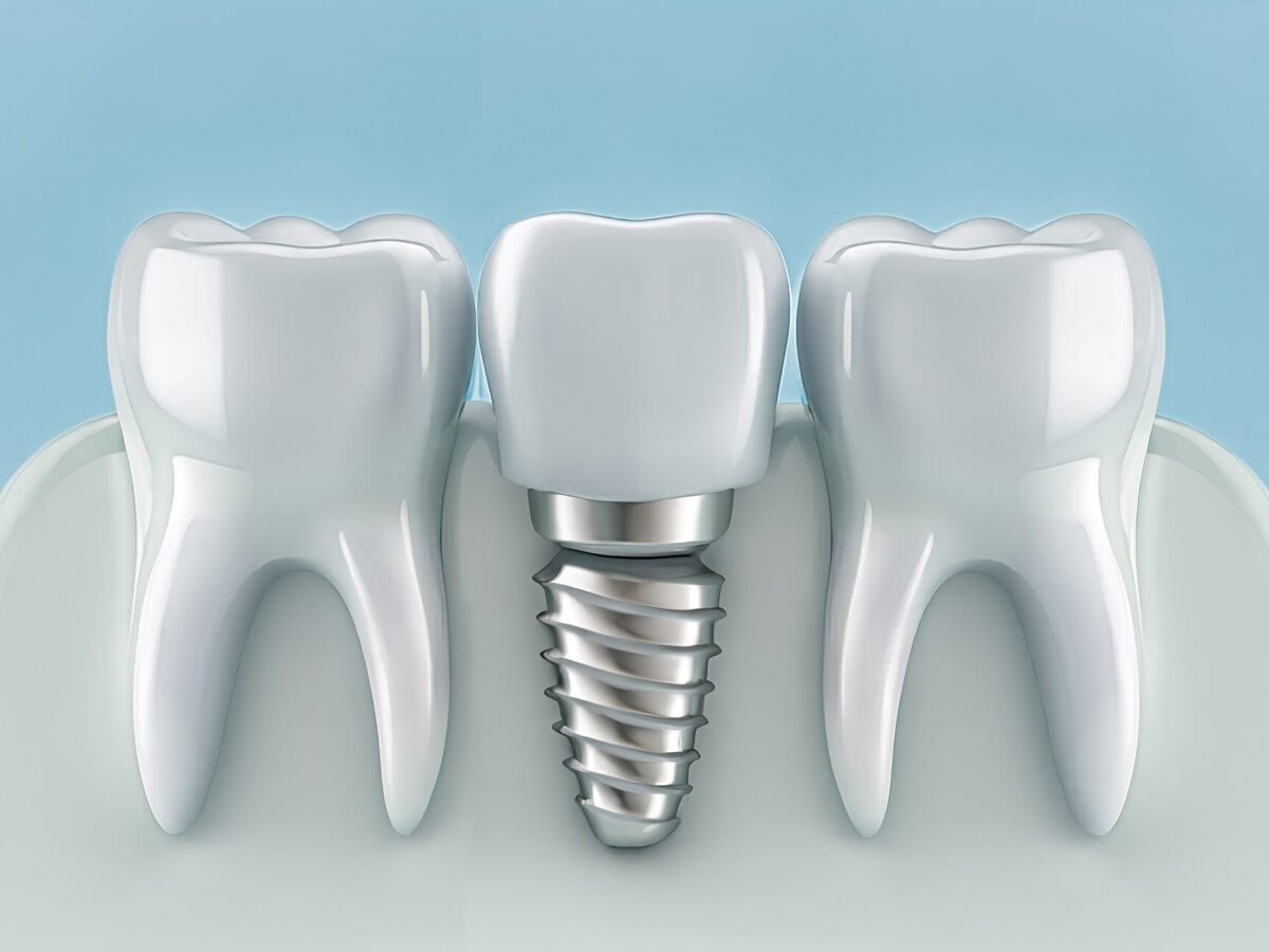 Jakie są rodzaje protez zębowych i czym się różnią?