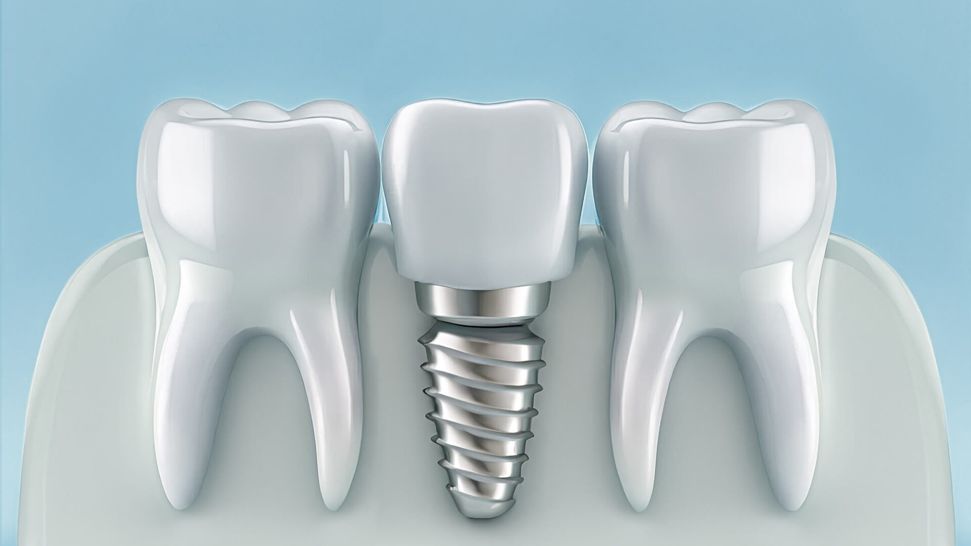 Jakie są rodzaje protez zębowych i czym się różnią?